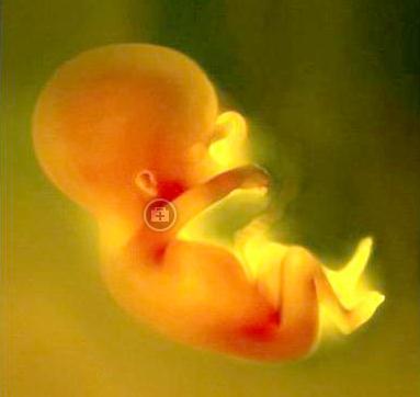 堕胎会影响现在的孩子吗?